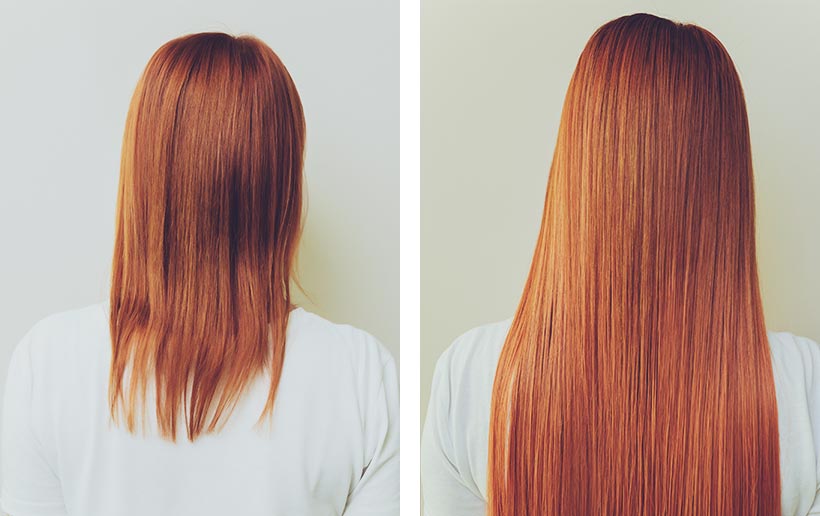 Vergleichsbild vorher mit kurzer und nachher mit langer Haarlänge nach der PRP Behandlung